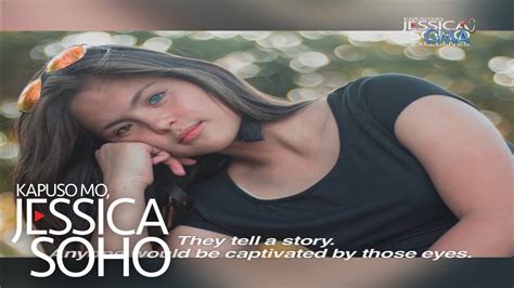 heterochromia pinay|Kapuso Mo, Jessica Soho: Meet Julia, two.